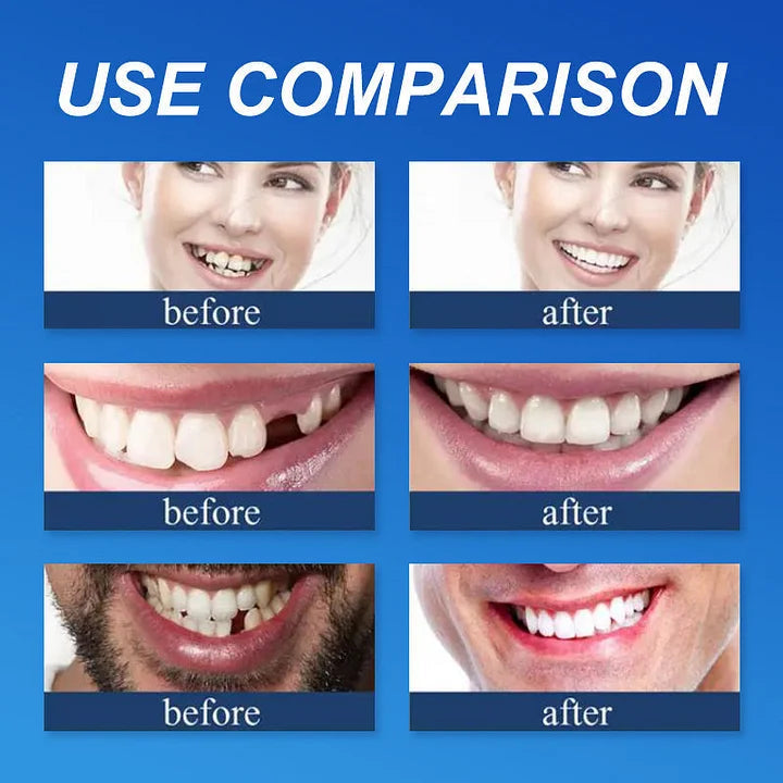 Ends Today: 70% OFF  Custom-Fit Full Functional Dentures