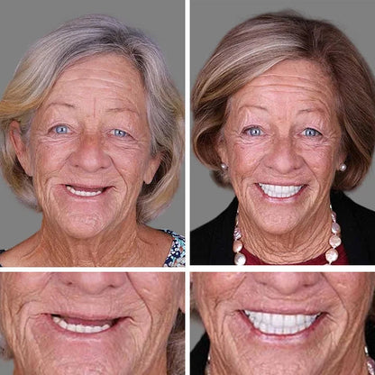 '-Ends Today: 70% OFF! ⏰DarkFairy™  Medical Full Denture with Strong Suctiond Custom-Fit Full Functional Dentures🦷Obtain American Dental Association (ADA) Certification